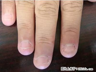 剪指甲、挖耳屎，这些日常小动作竟隐藏大危害！ - 图木舒克生活资讯 - 图木舒克28生活网 tmsk.28life.com